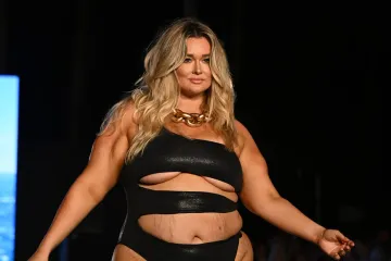 Sa stotinu kilograma samopouzdanja po pisti hoda kao gazela: 'Ne želim operacije'