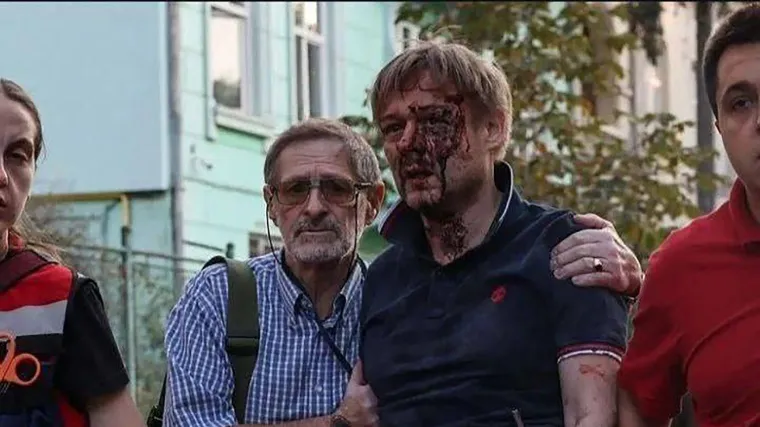 Ova slika obi&scaron;la je cijeli svijet. Jaroslav je u zvjerskom napadu izgubio tri kćeri i suprugu