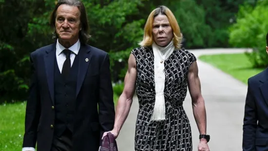 Izgubila dio nosa: Bila je princeza iz snova, a onda dobila infekciju i potpuno se deformirala