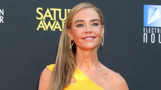 Denise Richards objavila fotografije prije i poslije estetskog zahvata: 'Bila sam prestravljena'