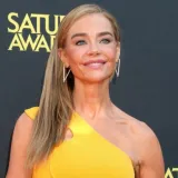 Denise Richards objavila fotografije prije i poslije estetskog zahvata: 'Bila sam prestravljena'