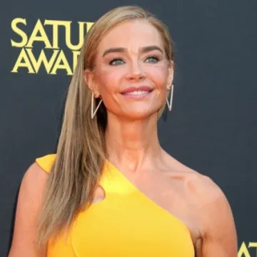 Denise Richards objavila fotografije prije i poslije estetskog zahvata: 'Bila sam prestravljena'