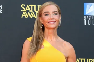 Denise Richards objavila fotografije prije i poslije estetskog zahvata: 'Bila sam prestravljena'