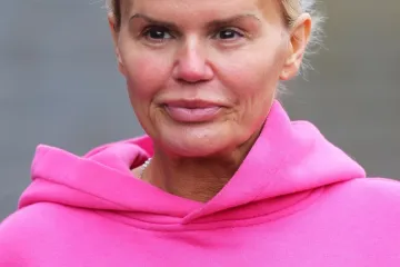 Estetske korekcije su je unakazile, borila se s ovisnostima: Kerry Katona nekad i sad