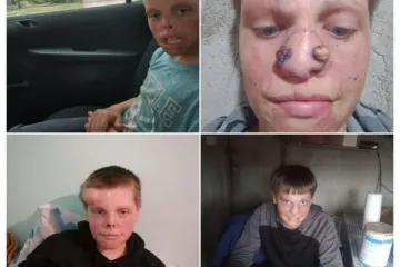 Kristijanova želja je biti poput drugih dječaka: Pomozimo mu da je ostvari!