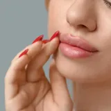 Kako se rije&scaron;iti ispucalih usana: Prirodni lijekovi koji stvarno djeluju