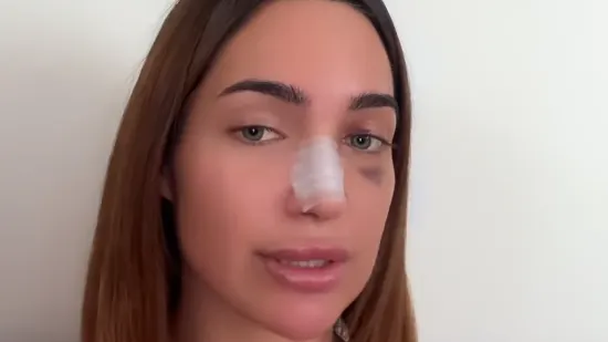 Laura iz 'Gospodina Savršenog' operirala nos: 'Radite korekcije zbog sebe'