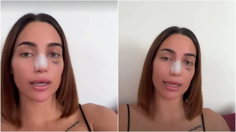 Laura otkrila da je bila na operaciji i usporedila svoje fotografije prije i nakon: 'Radite korekcije zbog sebe'