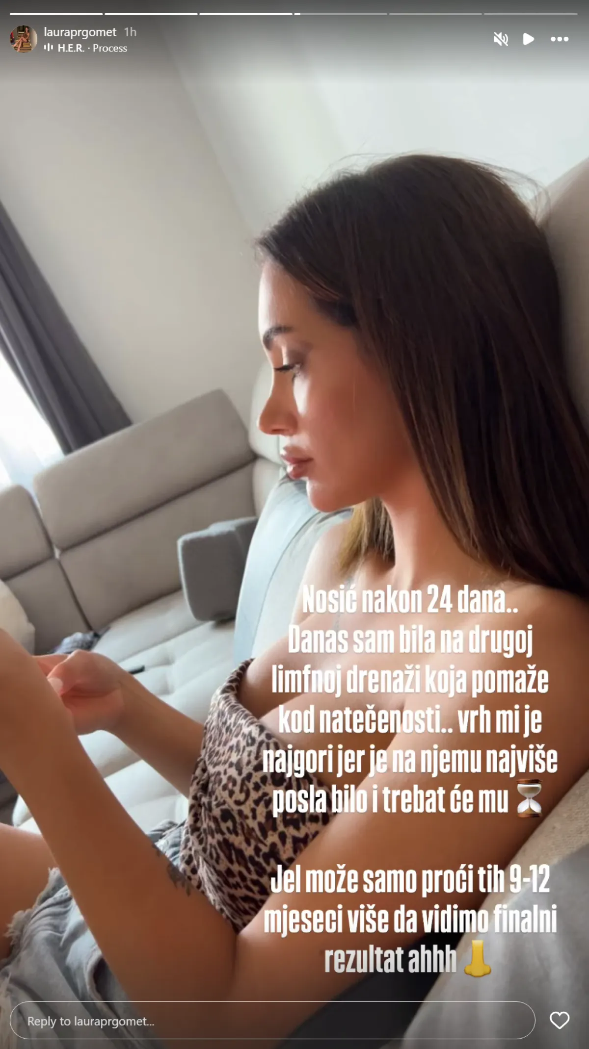 Laura iz 'Gospodina Savršenog' pokazala rezultat operacije: 'Bila sam na limfnoj drenaži'