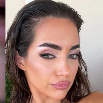 Laura iz 'Gospodina Savršenog' izvadila filere iz usana: Kako vam se sviđa?