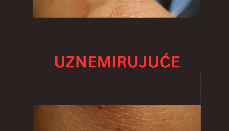 Prozori se rasprsnuli od udara vjetra: Splićanki se krhotine stakla zabile u rame!