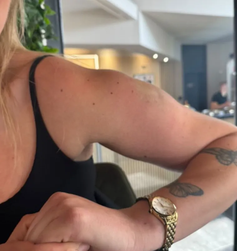 Ella ima 22 godine i rijedak oblik opake bolesti: 'Kad je pobijedim, gorit će grad!'