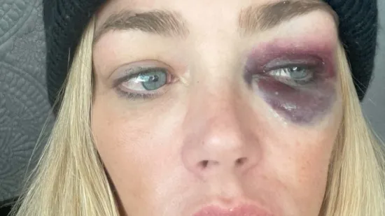 Denise Richards otvoreno o problemima s bivšim suprugom: 'Gušio me, šamarao, udarao...'