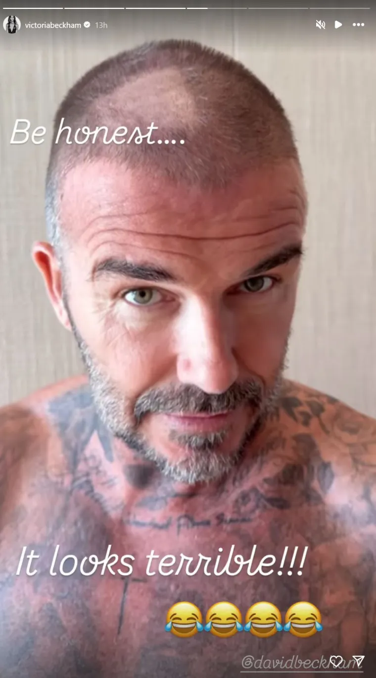 David Beckham ostao bez kose, reakcija Victorije iznenadila sve: 'Izgleda užasno'