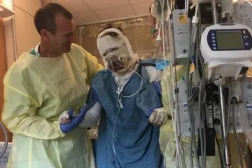 Prije šest godina je teško stradala u eksploziji plina, ljudi se ne mogu načuditi kako danas izgleda