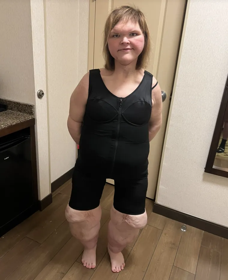 Zvijezda reality showa smršavila čak 225 kilograma: Pogledajte šokantnu transformaciju