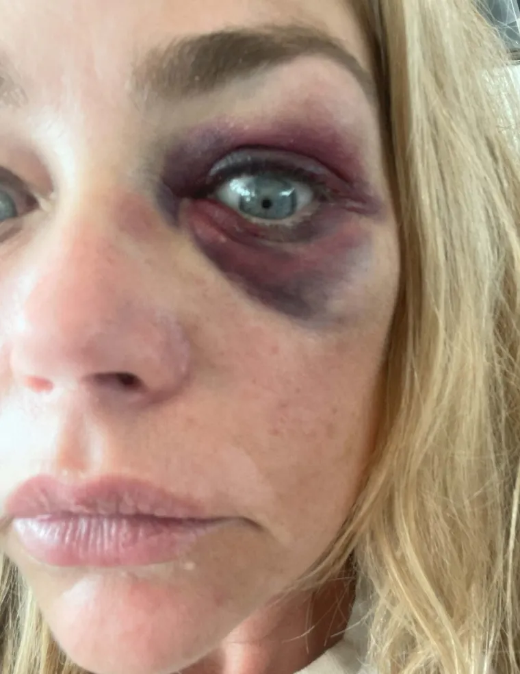 Denise Richards optužena za prevaru: Slala više od 100 eksplicitnih poruka sa tajnog mobitela
