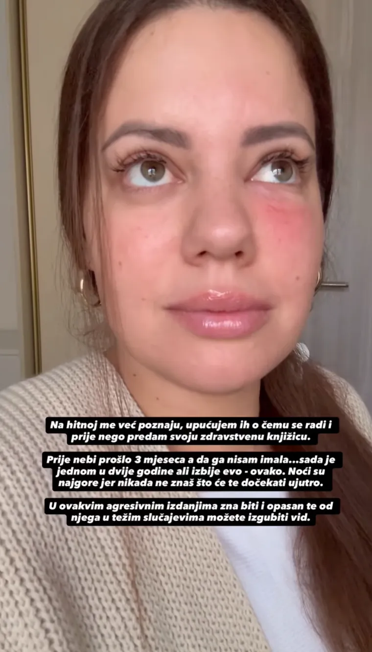 Lucija Lugomer o zdravstvenom problemu: 'Uplašila sam se jer je sve izmaklo kontroli'