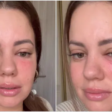 Lucija Lugomer o zdravstvenom problemu: 'Uplašila sam se jer je sve izmaklo kontroli'