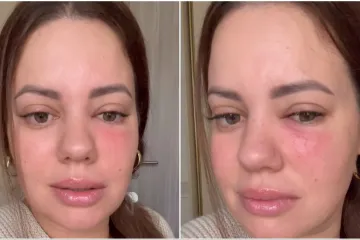 Lucija Lugomer o zdravstvenom problemu: 'Uplašila sam se jer je sve izmaklo kontroli'
