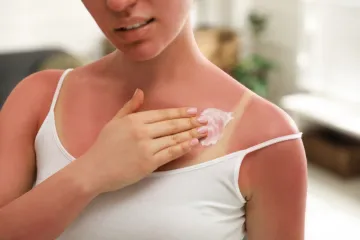 Dobili ste neobjašnjiv osip? Možda je krivo sunce, evo kako prepoznati i reagirati