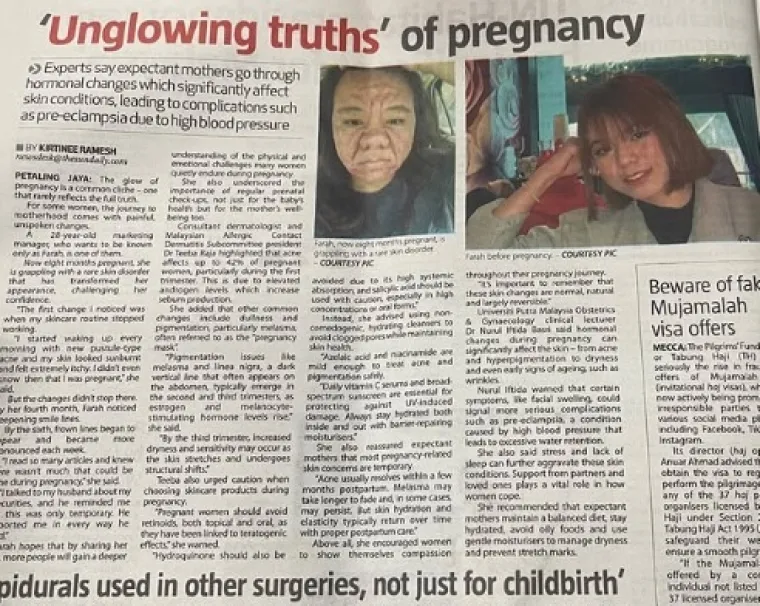 Trudnoća 28-godišnju djevojku pretvorila u staricu!