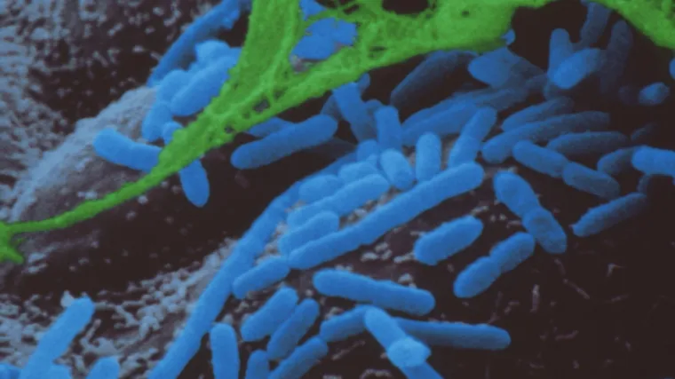 Povratak smrtonosne bakterijske infekcije izazvao zabrinutost u Europi: Koliko je opasan Hib?