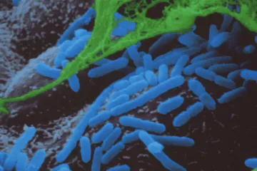 Povratak smrtonosne bakterijske infekcije izazvao zabrinutost u Europi: Koliko je opasan Hib?