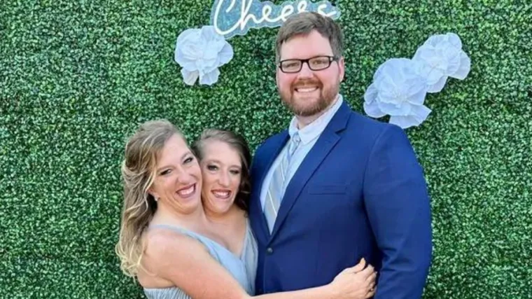 Jedno tijelo, dvije glave, jedna plaća, dvije diplome: Jesu li sijamske blizanke prave 'žrtve' kapitalizma?