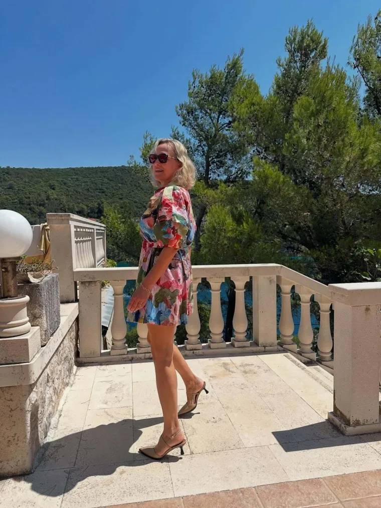 Vanna: 'Svojedobno sam izgledala kao leopard zbog hiperpigmentacije'