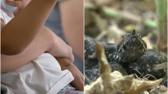 Tri ugriza zmije u pet dana: Dječaku otkazivali organi, stručnjaci otkrili što ga je spasilo