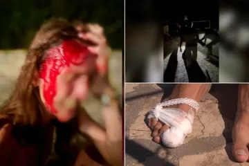 Policija razotkrila istinu o premlaćivanju Slovenaca: Zaštitari mlatili Slovence, tukli i palicom po glavi!