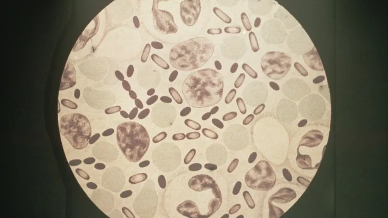 Zarazio se 'crnom smrću': Stanovnicima izdano upozorenje