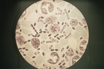 Zarazio se 'crnom smrću': Stanovnicima izdano upozorenje