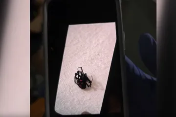 Kad pauk napadne: Ima li Hrvatska dovoljno protuotrova?