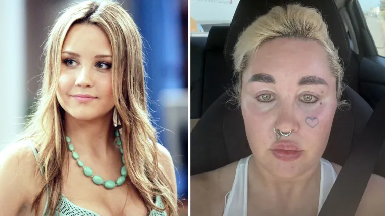 Amanda Bynes podvrgnula se još jednom kozmetičkom zahvatu: Ne prestaje šokirati izgledom