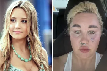 Amanda Bynes podvrgnula se još jednom kozmetičkom zahvatu: Ne prestaje šokirati izgledom