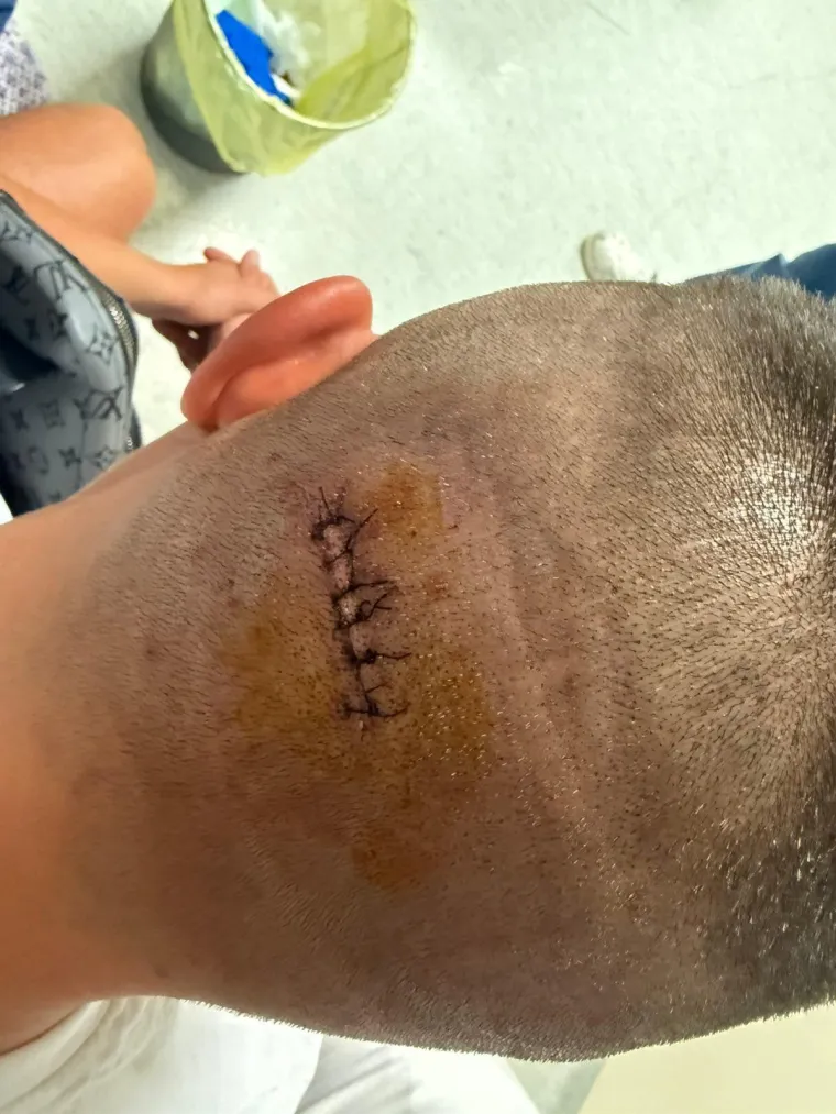 Uhićen trojac koji je napao Slovence: Što se točno dogodilo u kafiću u Umagu?