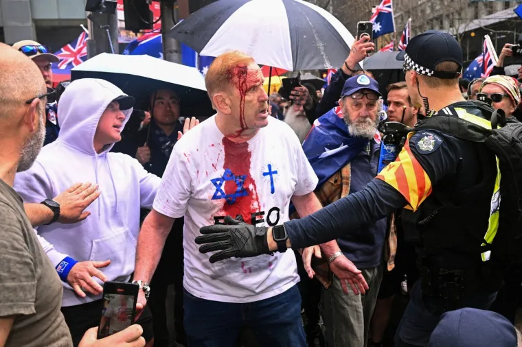 Sydney u kaosu! Tisuće na marševima protiv imigracije: Vlada šokirana, povezuju ih s neonacistima