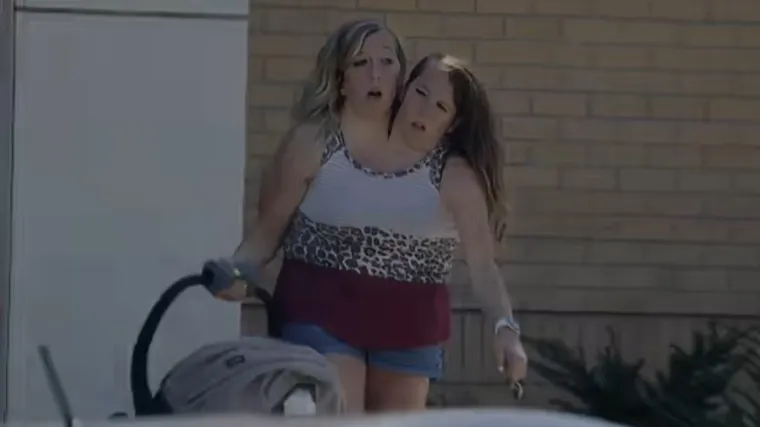 Sijamske blizanke rodile bebu? Dvije glave, dva srca, ali ispod pojasa - sve dijele