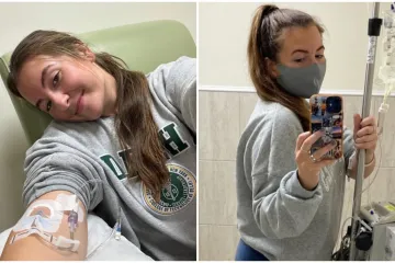 Bol u oku bio je prvi znak ozbiljne autoimune bolesti: 'Isprva sam sve pripisivala umoru'