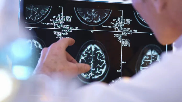 Omiljeni napici mogli bi ubrzavati starenje mozga. Liječnici zabrinuti za dvije skupine ljudi