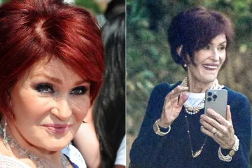 Upali obrazi i obješena koža: Sharon Osbourne lijek za mršavljenje uništio lice