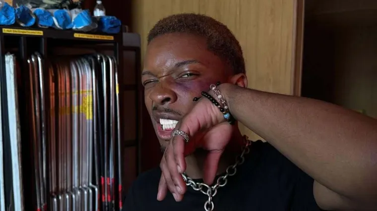 Kao u filmu! U prtljažniku Tesle poznatog glazbenika pronađeno mrtvo tijelo