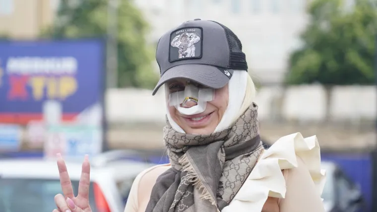 Operirala nos sedam puta, a rezultat je bizaran: Pogledajte kako izgleda voditeljica nakon zahvata