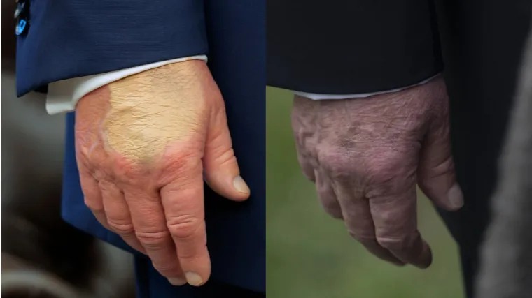 Zašto Trump nosi puder na ruci? Posjet Britaniji potaknuo nagađanja