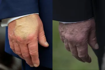 Zašto Trump nosi puder na ruci? Posjet Britaniji potaknuo nagađanja