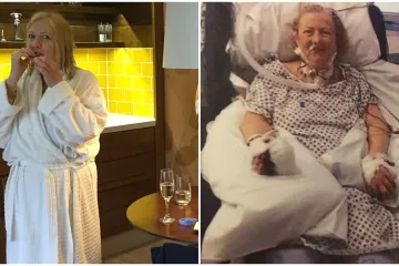 Žena (69) zbog liječničke pogreške ostala bez prstiju: 'Hodanje je bolno i iscrpljujuće'