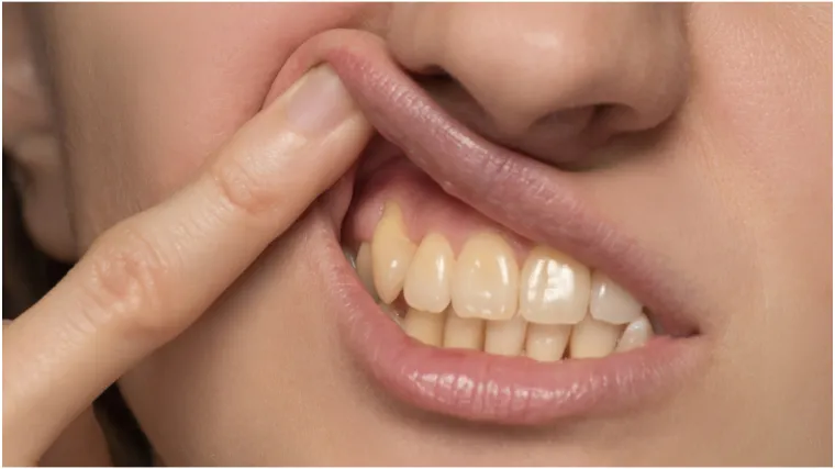 Zubarica objašnjava: 'Iako redovito perete zube, oni su i dalje žuti. Evo zašto'