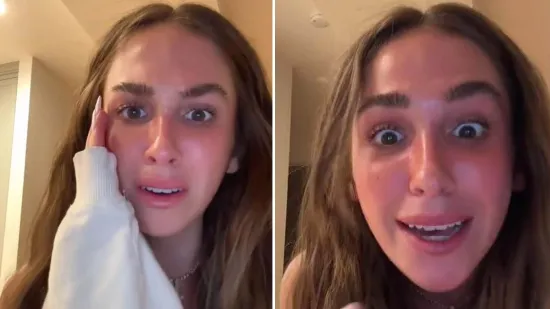 Influencerica otkrila da ju je majka s 14 godina prisilno odvela na lasersko uklanjanje pjegica